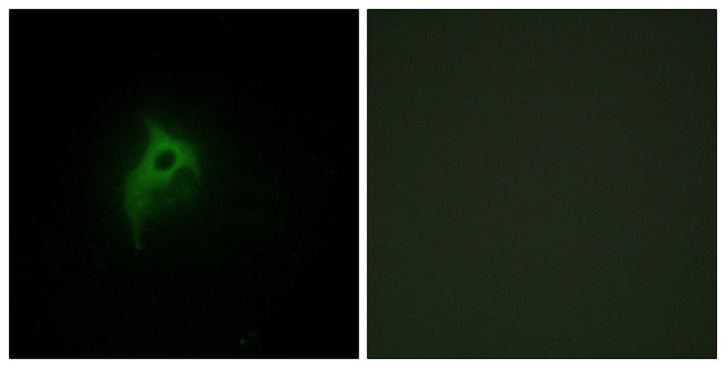 AR α2B Rabbit Polyclonal Antibody
