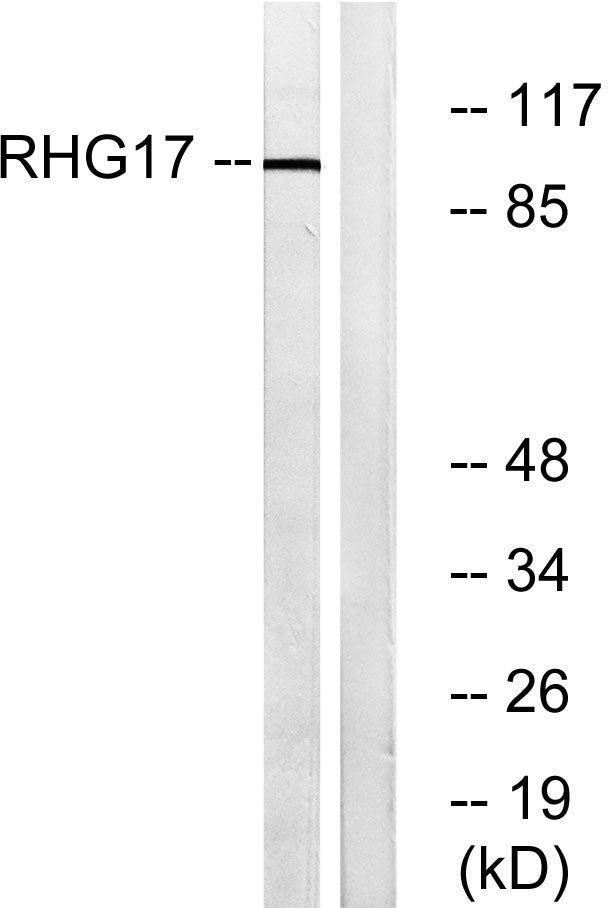ARHGAP17 Rabbit Polyclonal Antibody