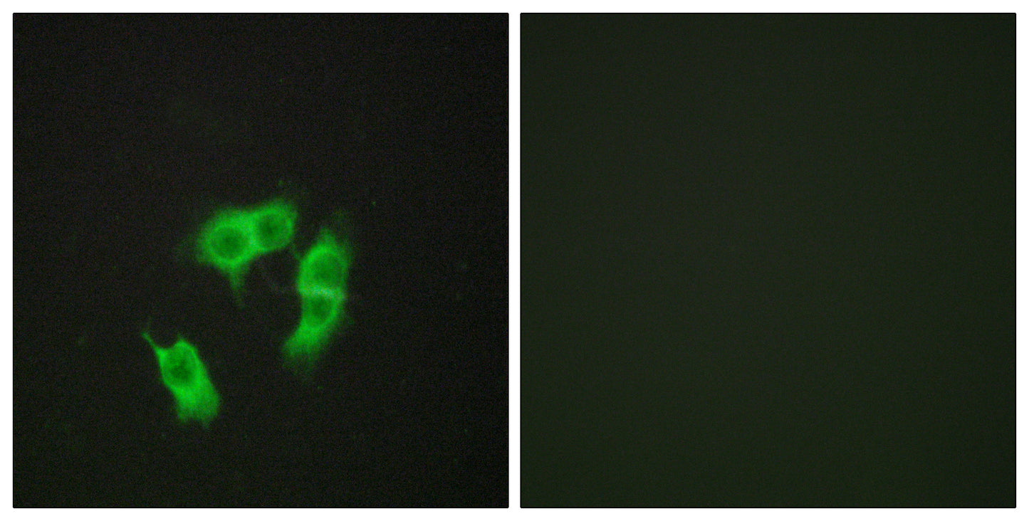 ARMCX3 Rabbit Polyclonal Antibody
