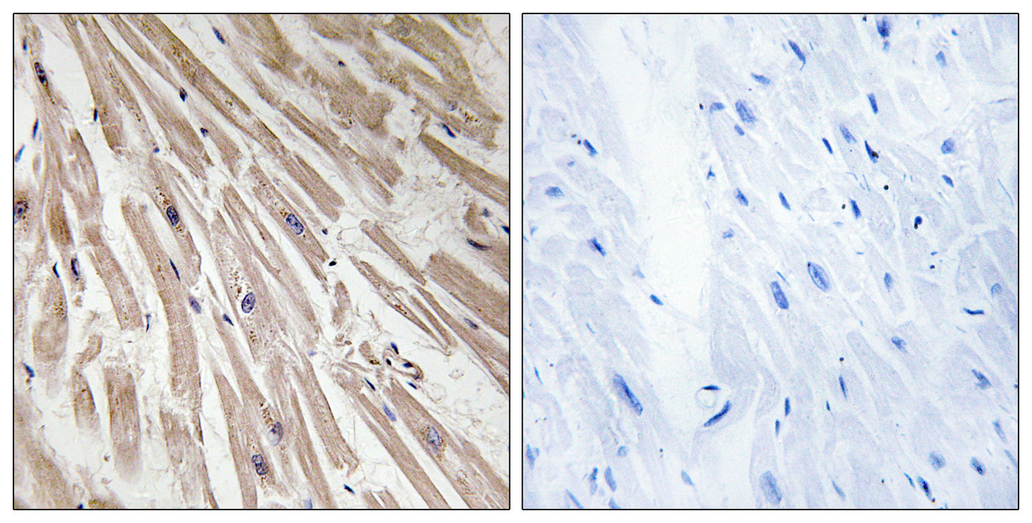 ARPP-21 Rabbit Polyclonal Antibody