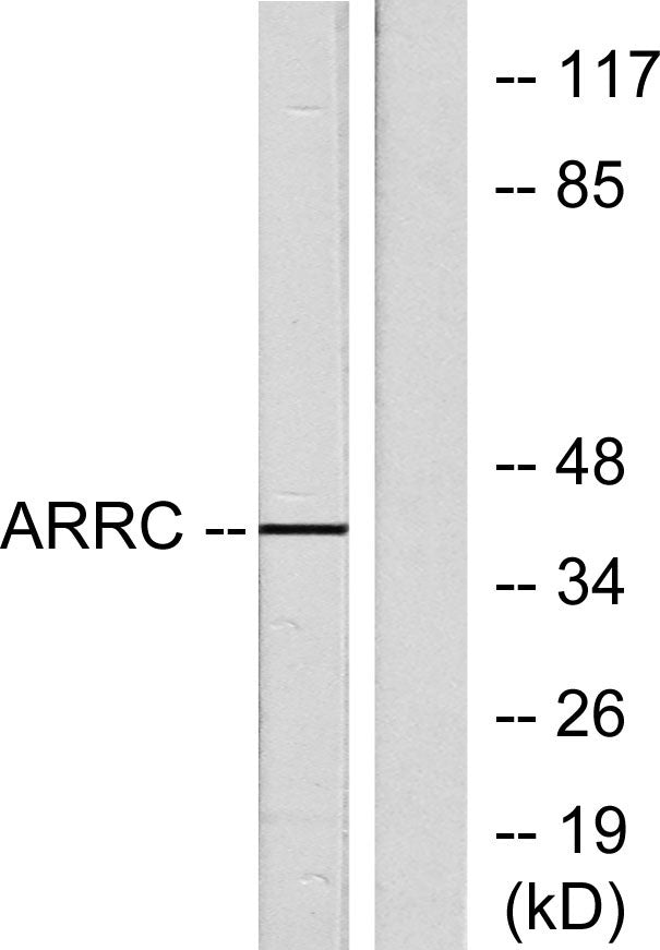Arrestin-C Rabbit Polyclonal Antibody
