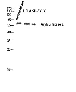 Arylsulfatase E Rabbit Polyclonal Antibody