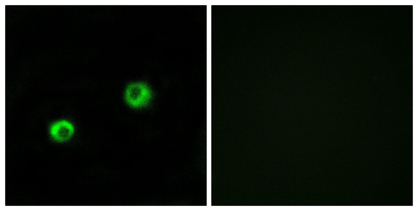 Arylsulfatase I Rabbit Polyclonal Antibody