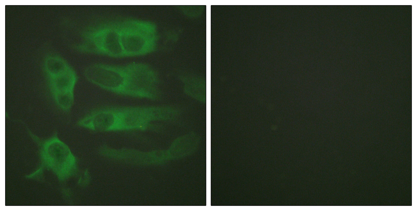 AR-β2 Rabbit Polyclonal Antibody
