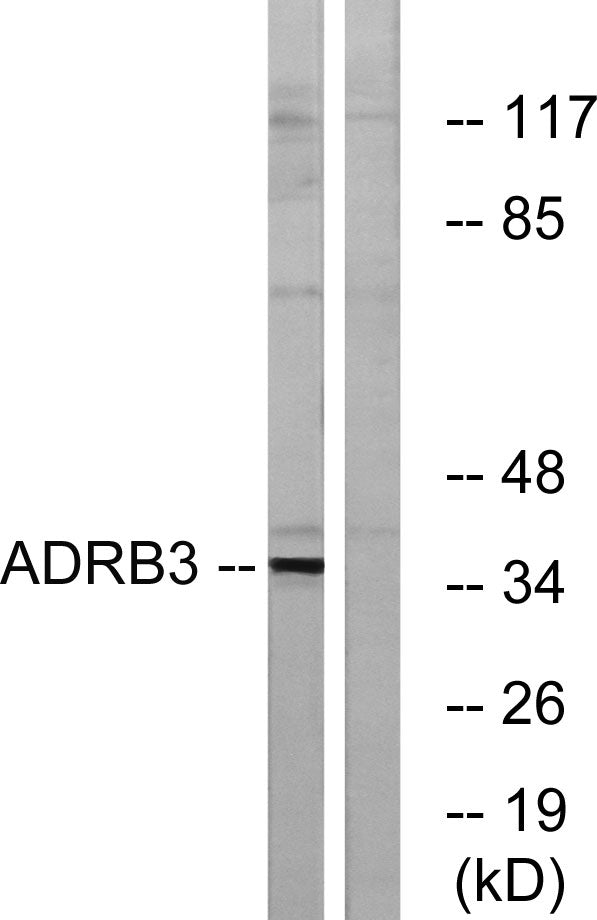 AR-β3 Rabbit Polyclonal Antibody