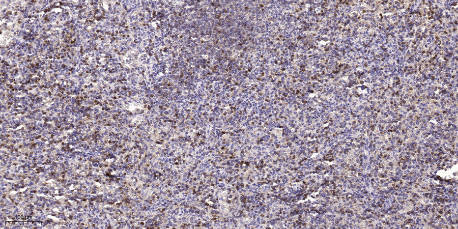 ASPM Rabbit Polyclonal Antibody