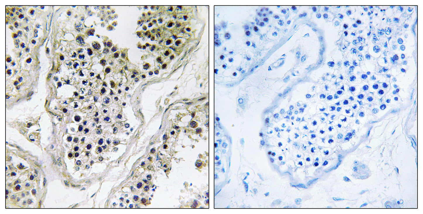 Ataxin-7L1 Rabbit Polyclonal Antibody