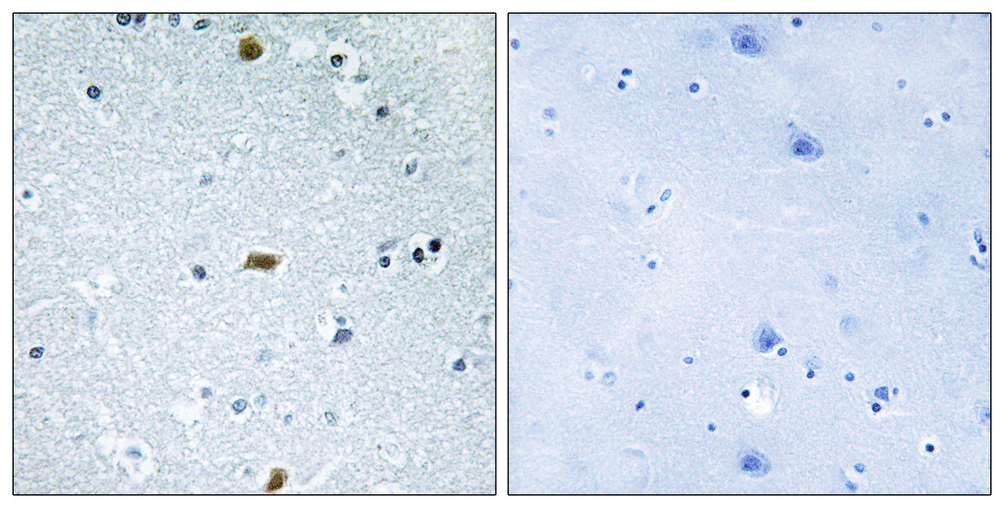 ATBF1 Rabbit Polyclonal Antibody