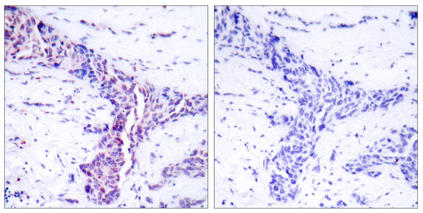 ATF-2 Rabbit Polyclonal Antibody