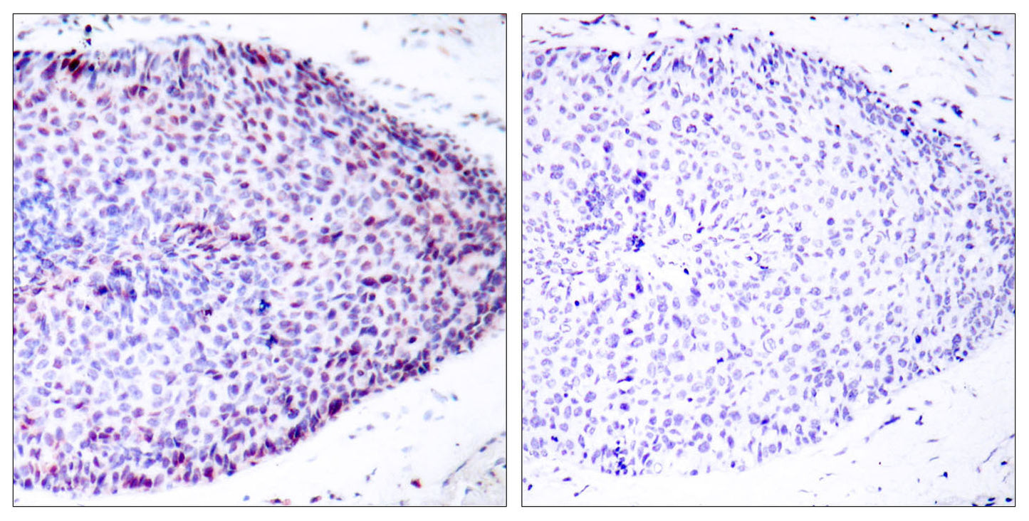 ATF-2 Rabbit Polyclonal Antibody