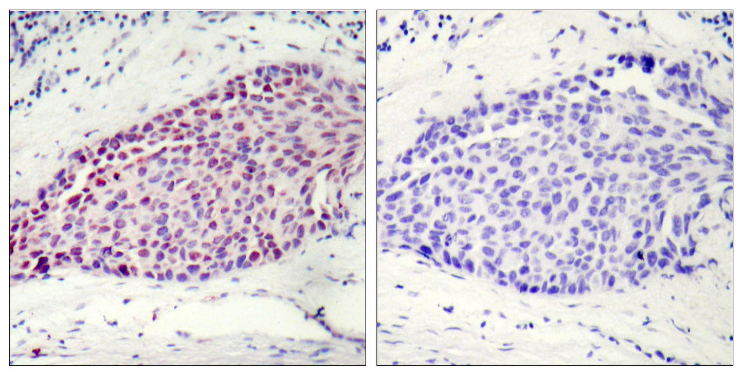 ATF-2 Rabbit Polyclonal Antibody