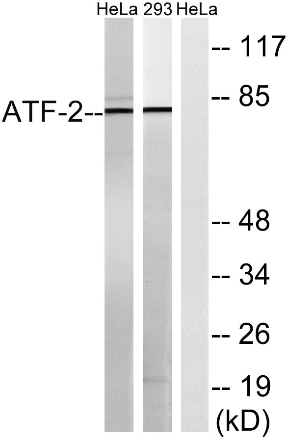 ATF-2 Rabbit Polyclonal Antibody