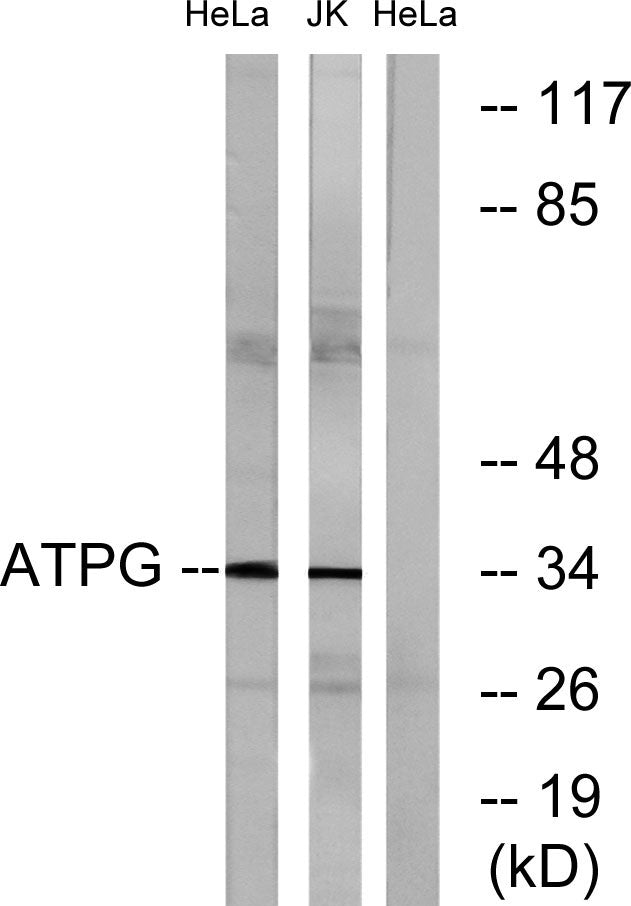 ATP5C1 Rabbit Polyclonal Antibody