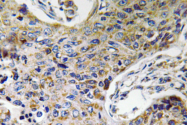 ATP5J2 Rabbit Polyclonal Antibody