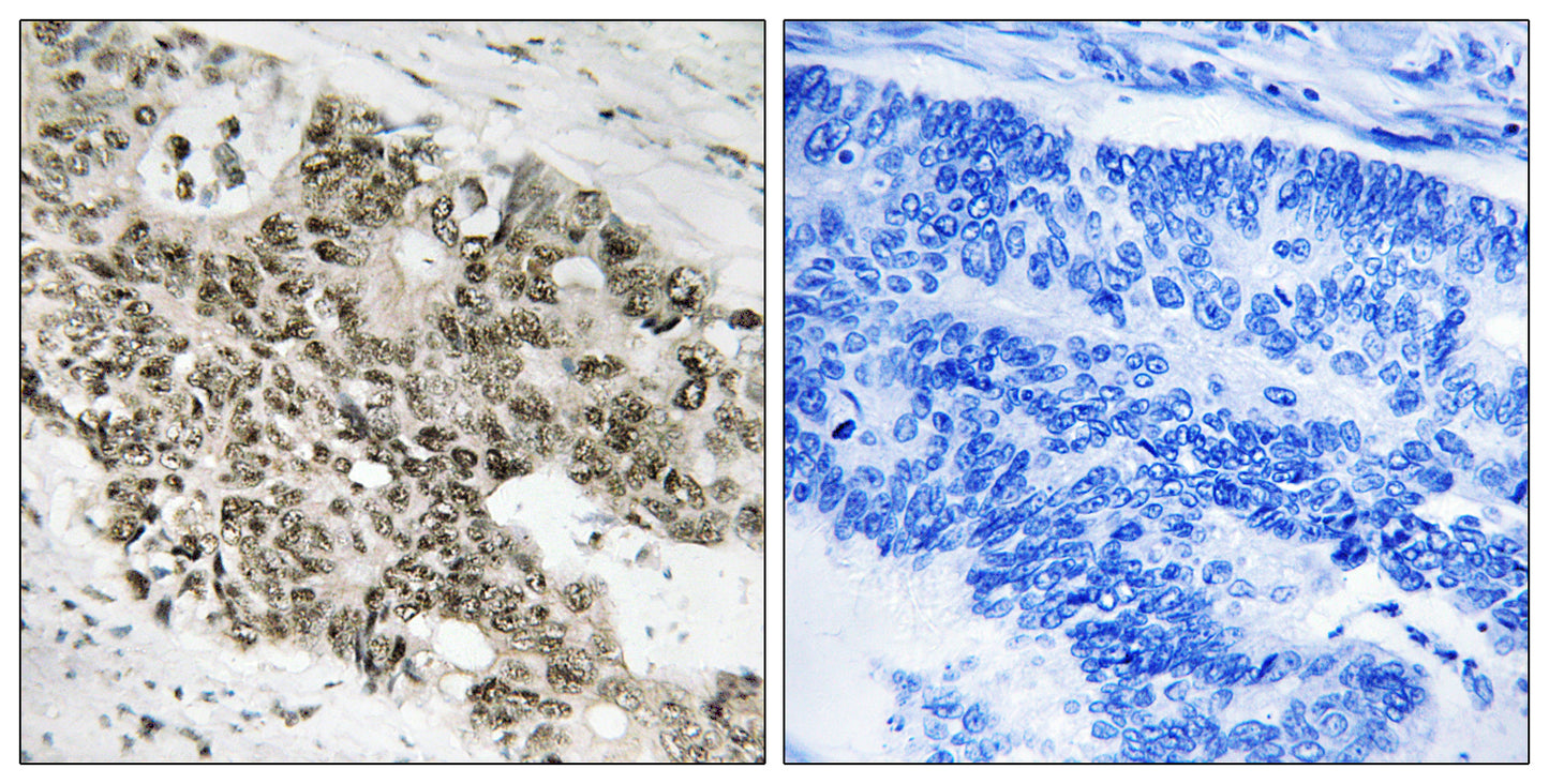 ATR Rabbit Polyclonal Antibody