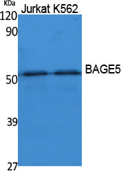BAGE5 Rabbit Polyclonal Antibody