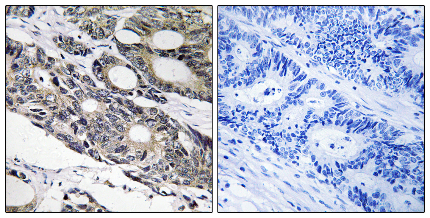 Bcl-10 Rabbit Polyclonal Antibody