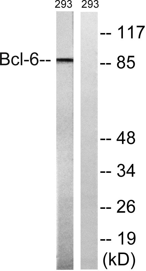 Bcl-6 Rabbit Polyclonal Antibody