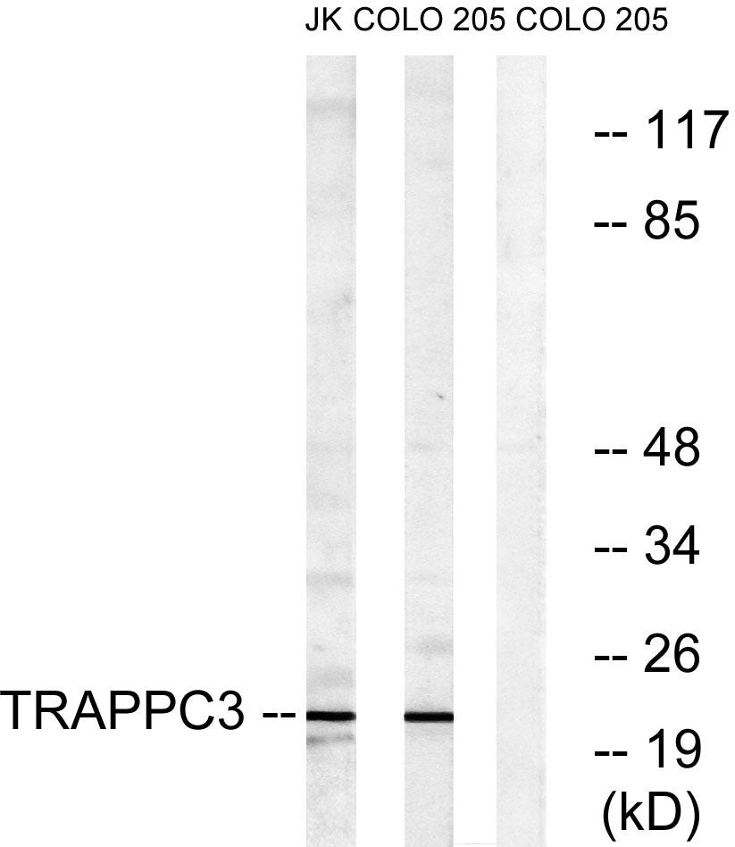 BET3 Rabbit Polyclonal Antibody