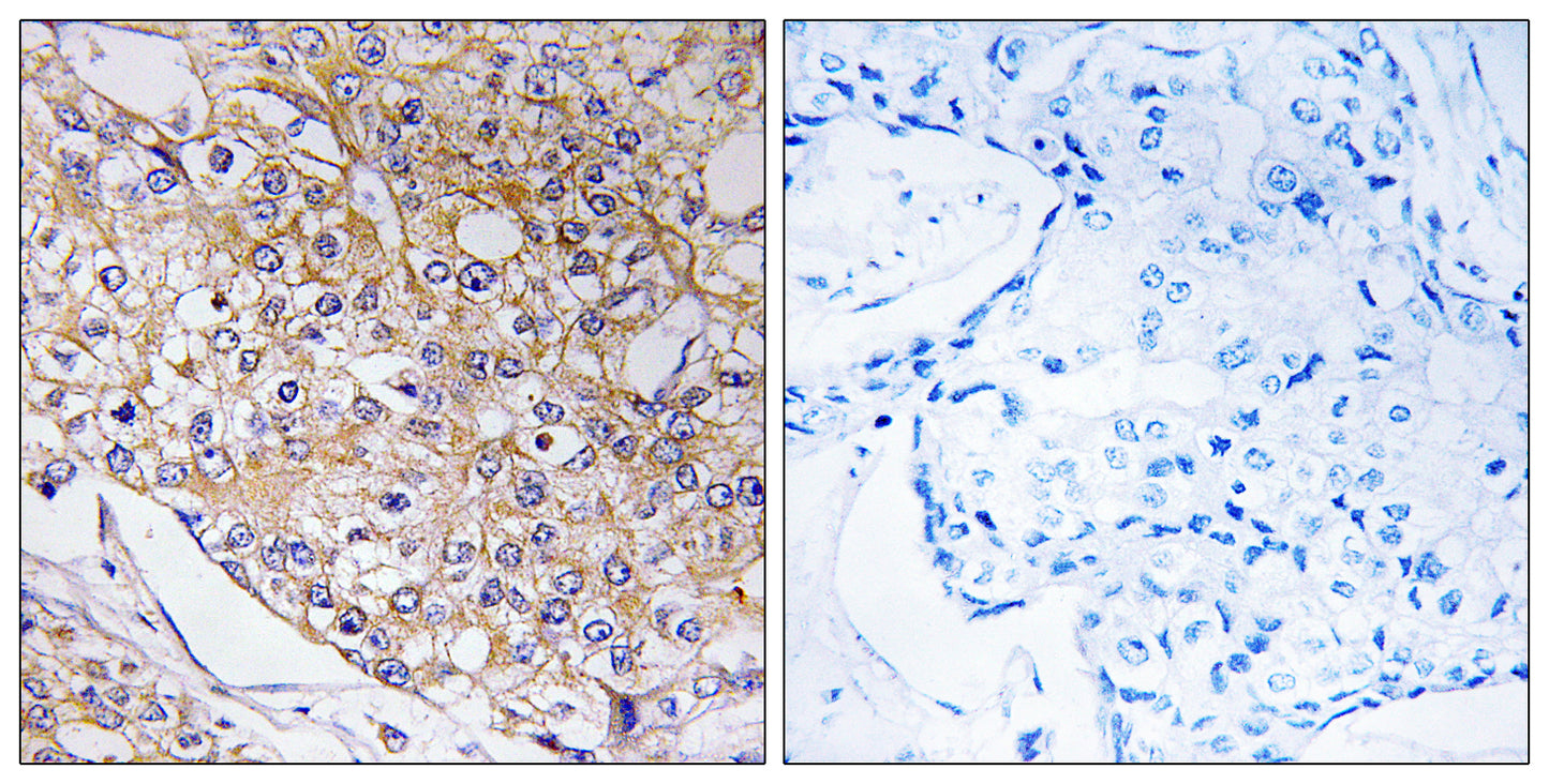 BET5 Rabbit Polyclonal Antibody
