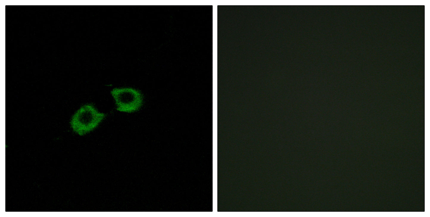 BIG2 Rabbit Polyclonal Antibody