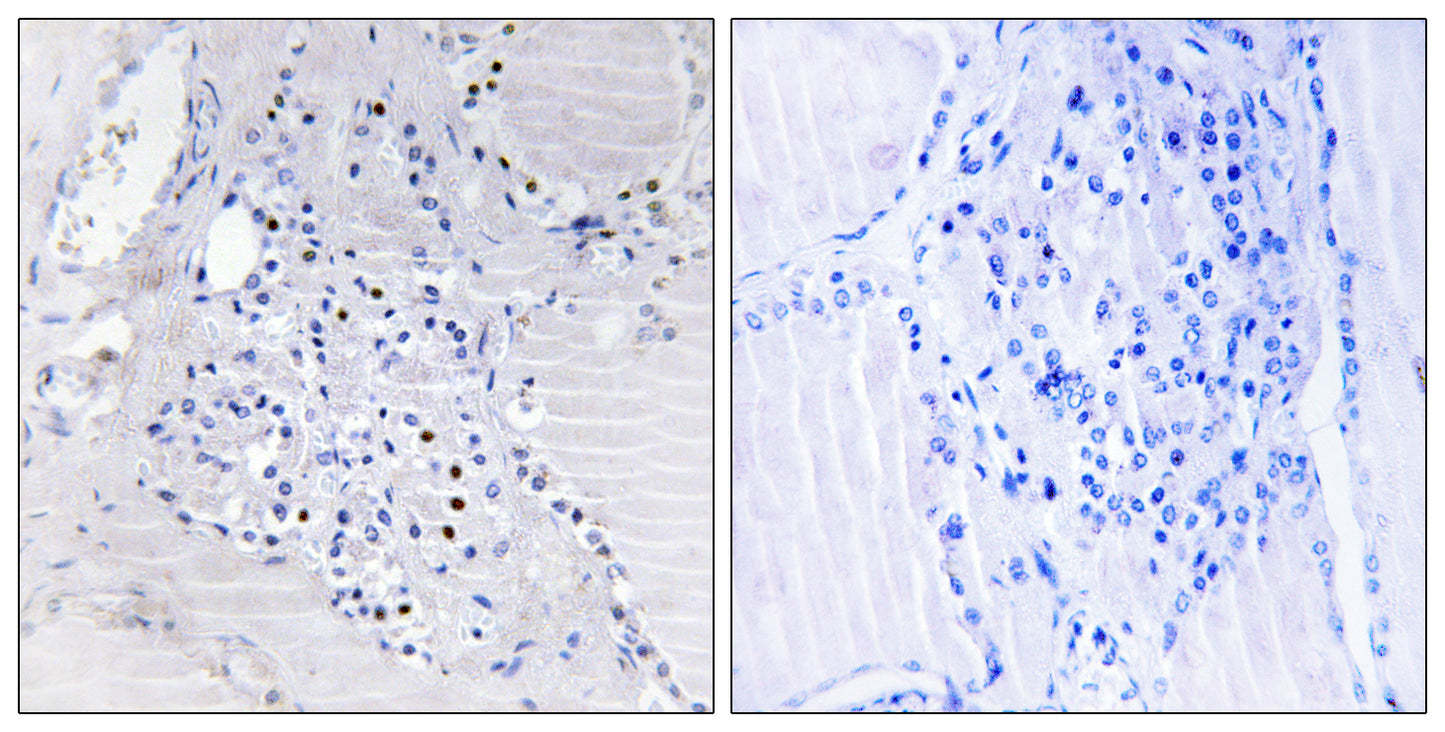 BinCARD Rabbit Polyclonal Antibody