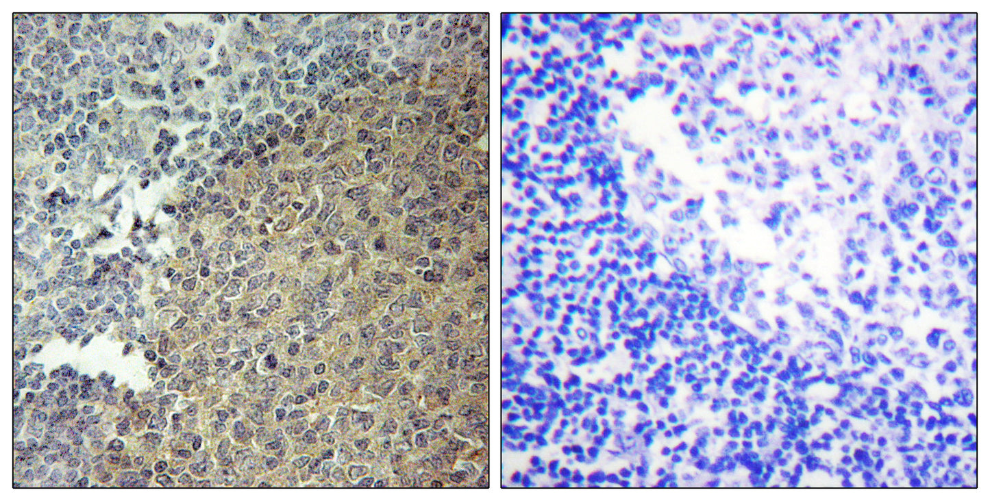 BLNK Rabbit Polyclonal Antibody