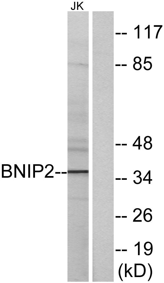 BNIP-2 Rabbit Polyclonal Antibody