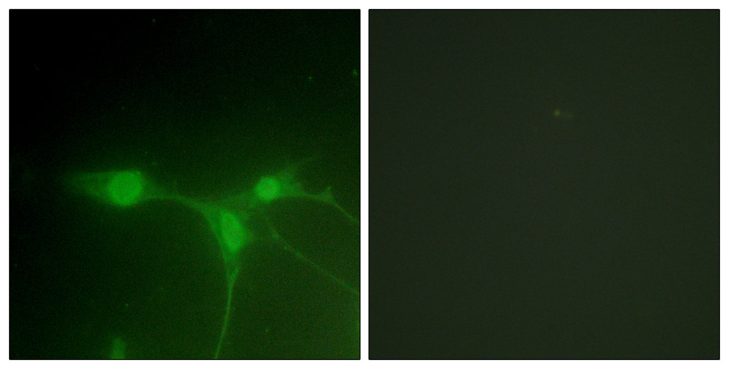 Brk Rabbit Polyclonal Antibody