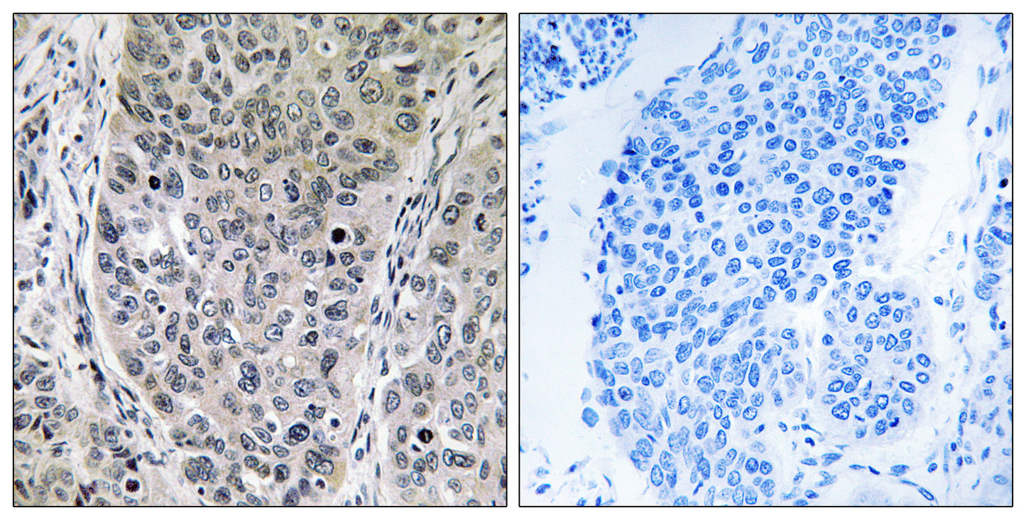Brp16 Rabbit Polyclonal Antibody