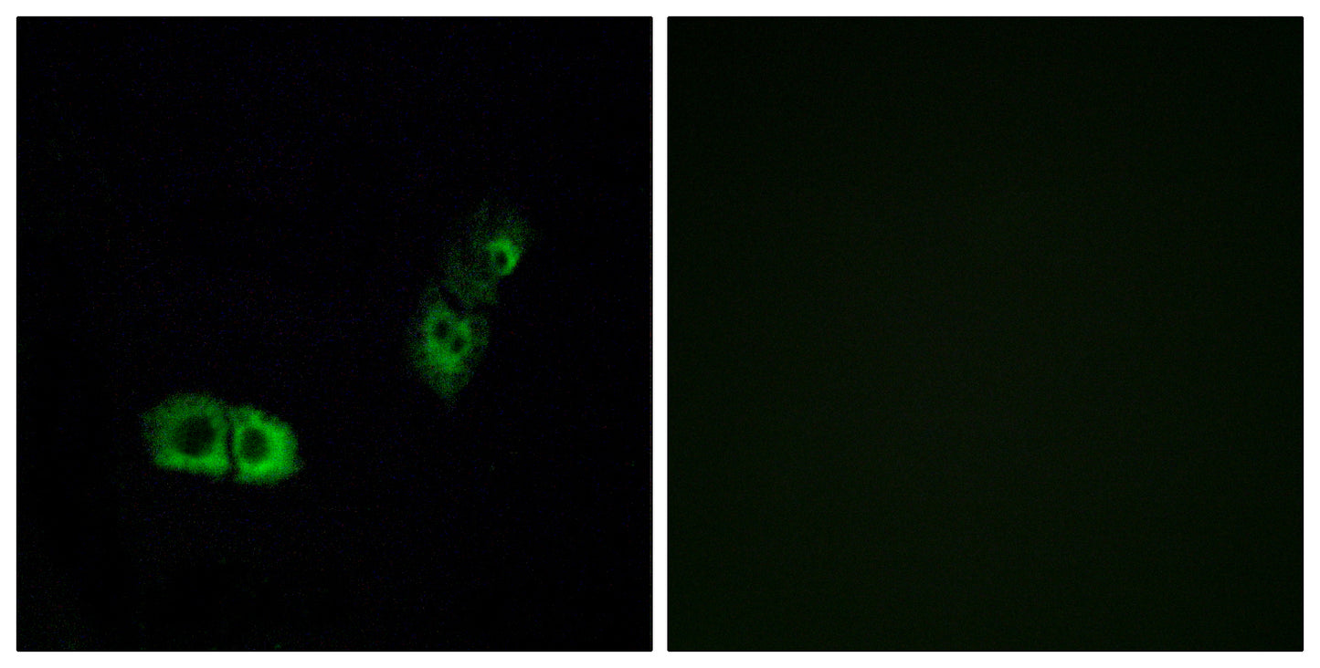 BRS-3 Rabbit Polyclonal Antibody