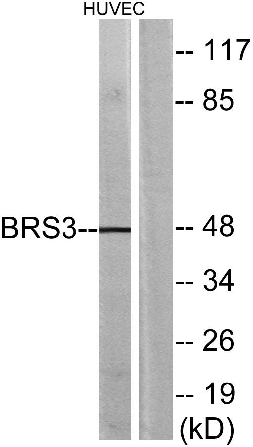 BRS-3 Rabbit Polyclonal Antibody