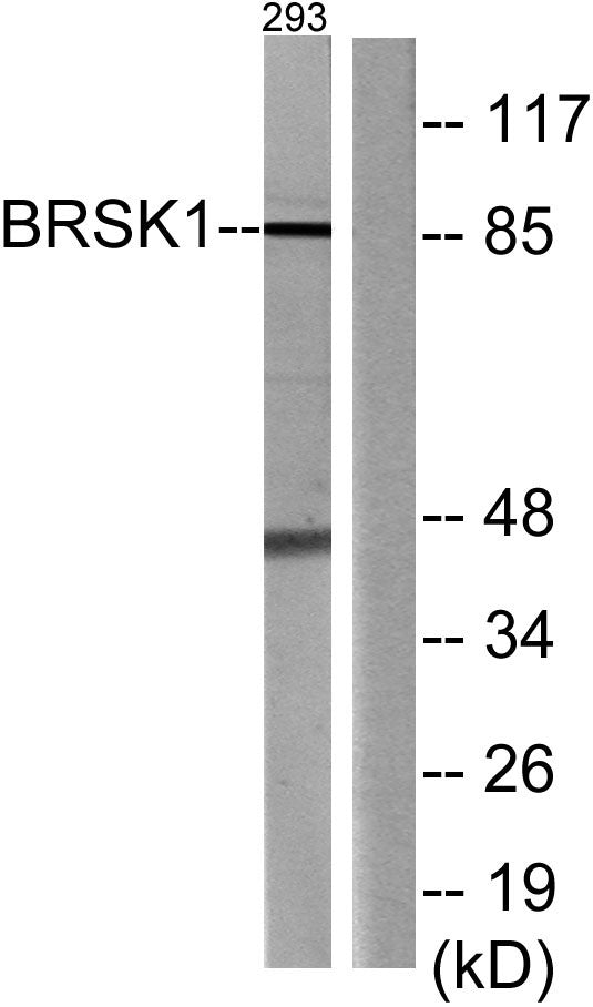 BRSK1 Rabbit Polyclonal Antibody