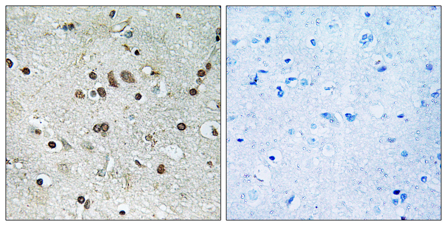 BTF3L4 Rabbit Polyclonal Antibody