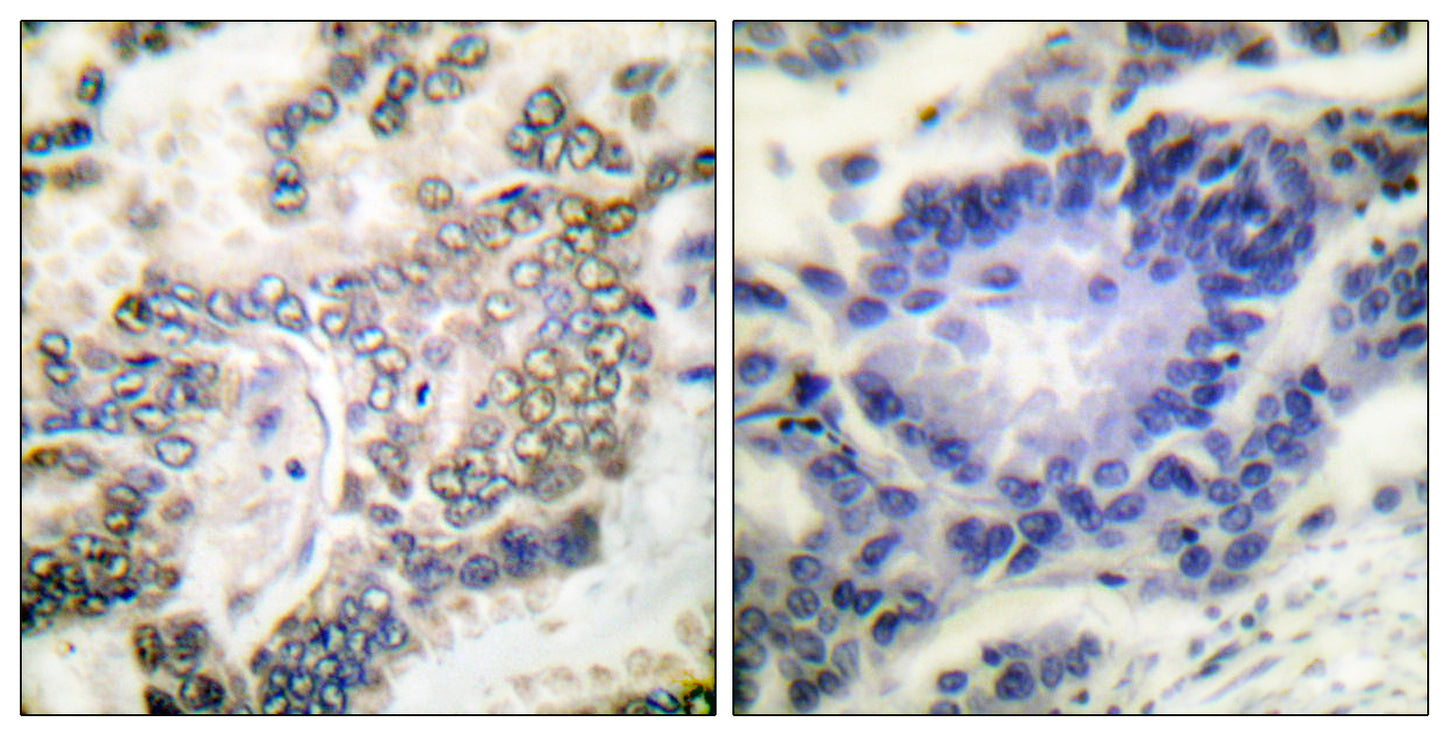 C/EBP α Rabbit Polyclonal Antibody