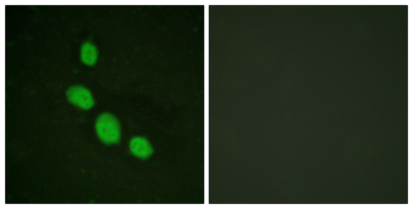 C/EBP ε Rabbit Polyclonal Antibody
