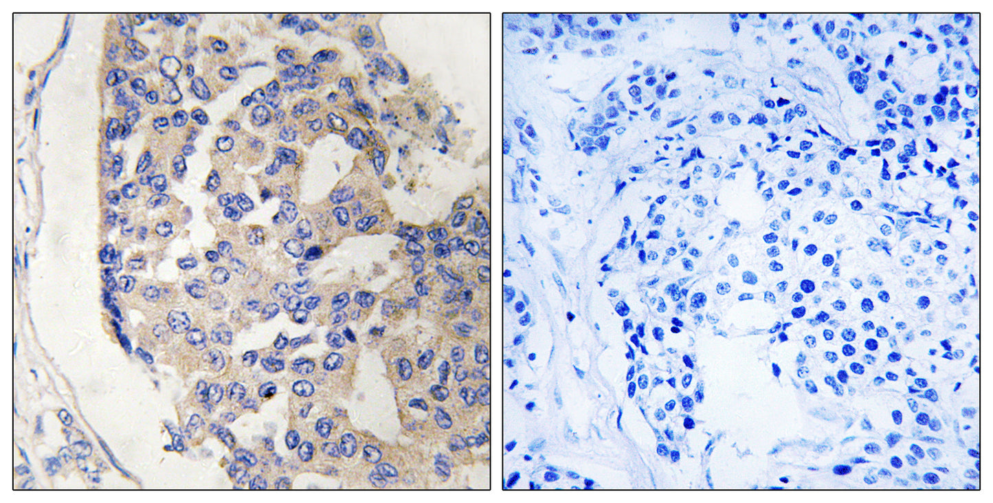 C1s Rabbit Polyclonal Antibody