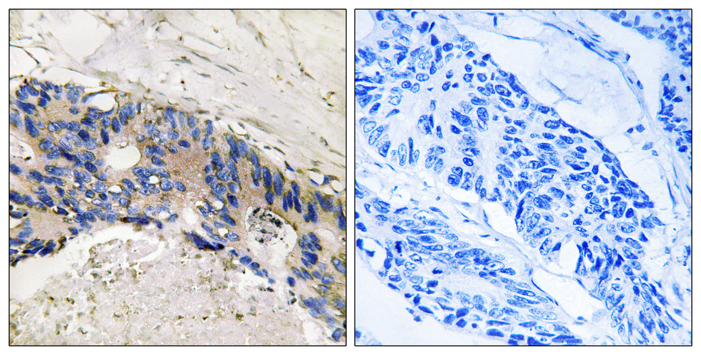 CA I Rabbit Polyclonal Antibody