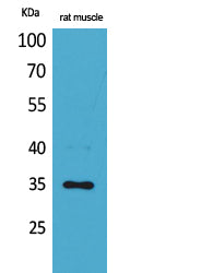 CA IV Rabbit Polyclonal Antibody
