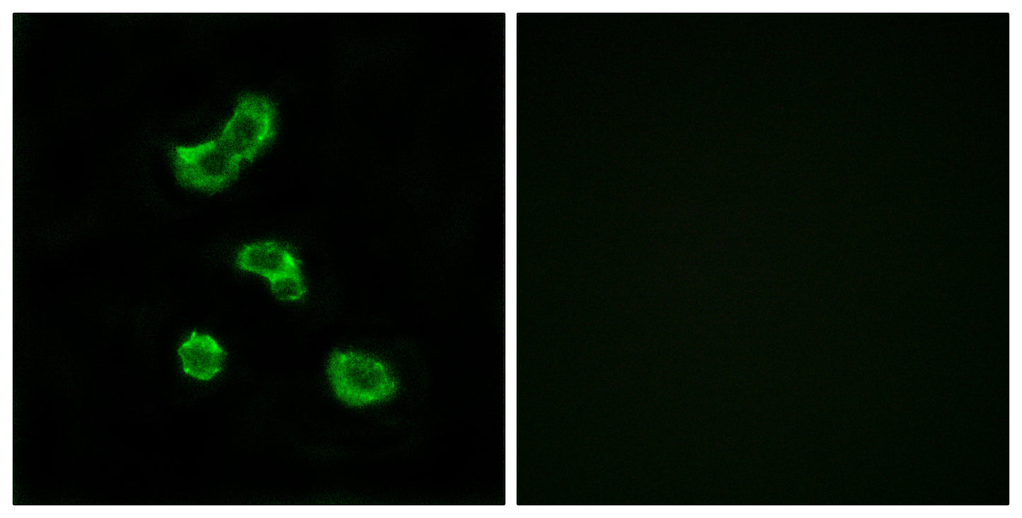 CA VB Rabbit Polyclonal Antibody