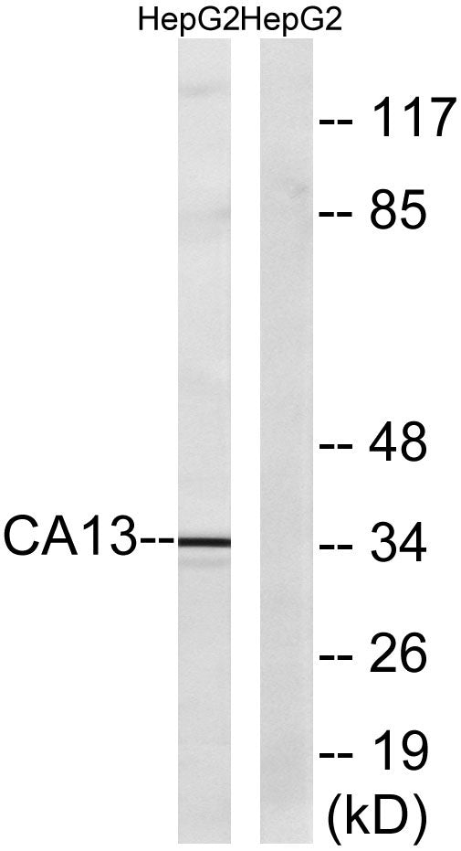 CA XIII Rabbit Polyclonal Antibody