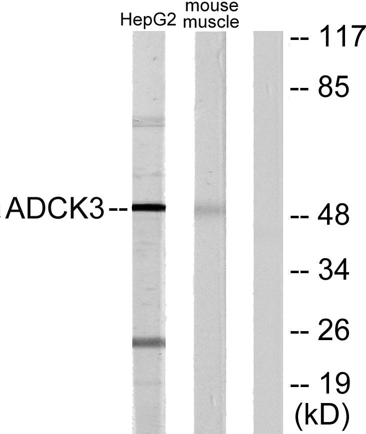 CABC1 Rabbit Polyclonal Antibody