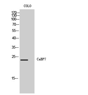 CaBP7 Rabbit Polyclonal Antibody