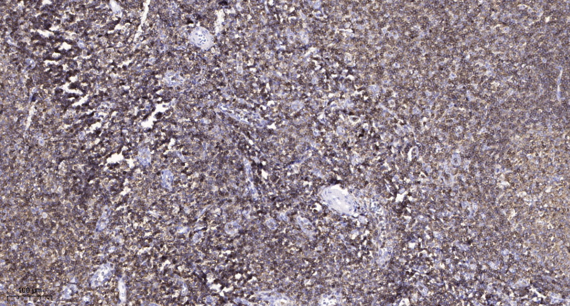 CAC1G Rabbit Polyclonal Antibody