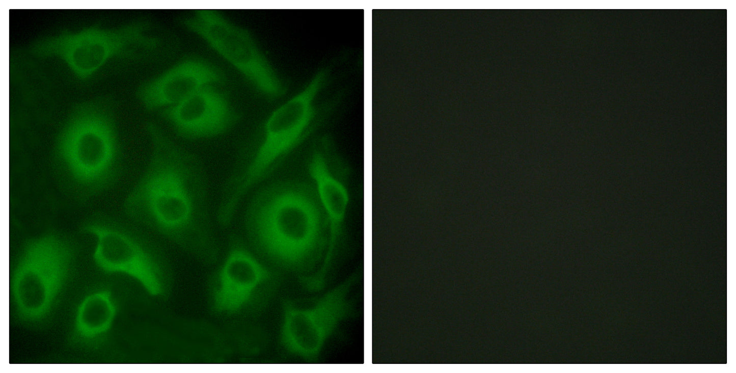 Cadherin-23 Rabbit Polyclonal Antibody