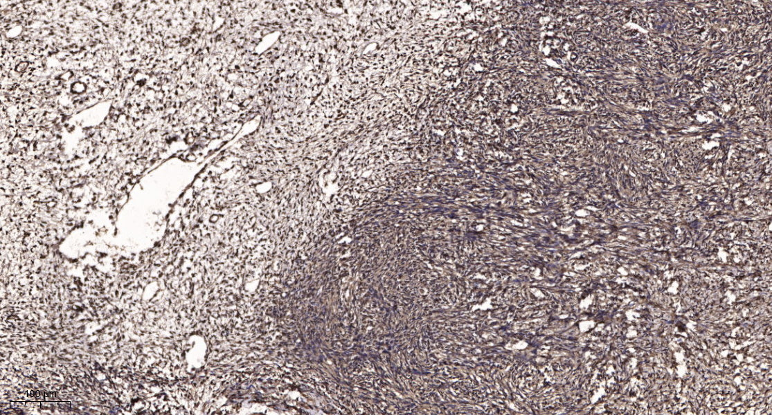 Calgizzarin Rabbit Polyclonal Antibody