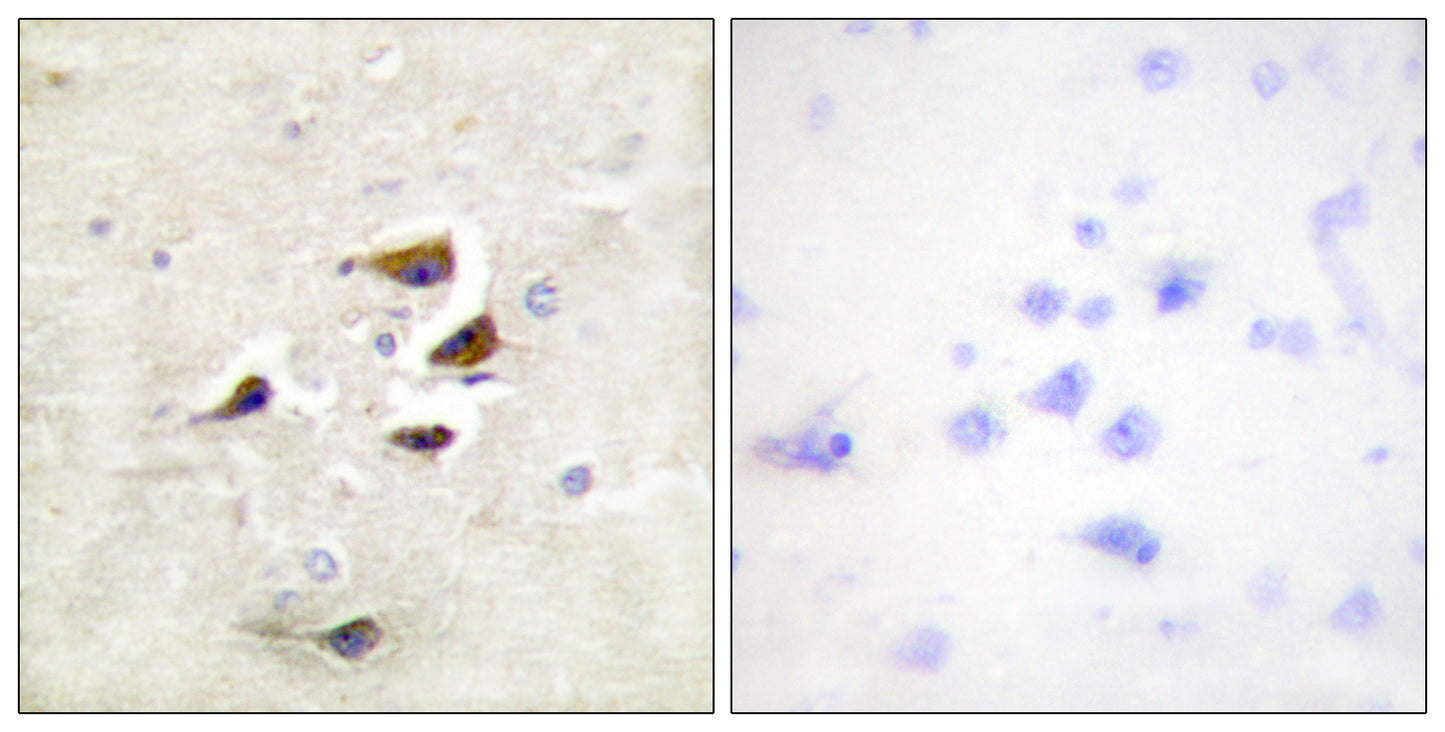 CaMKIIα/β/δ Rabbit Polyclonal Antibody