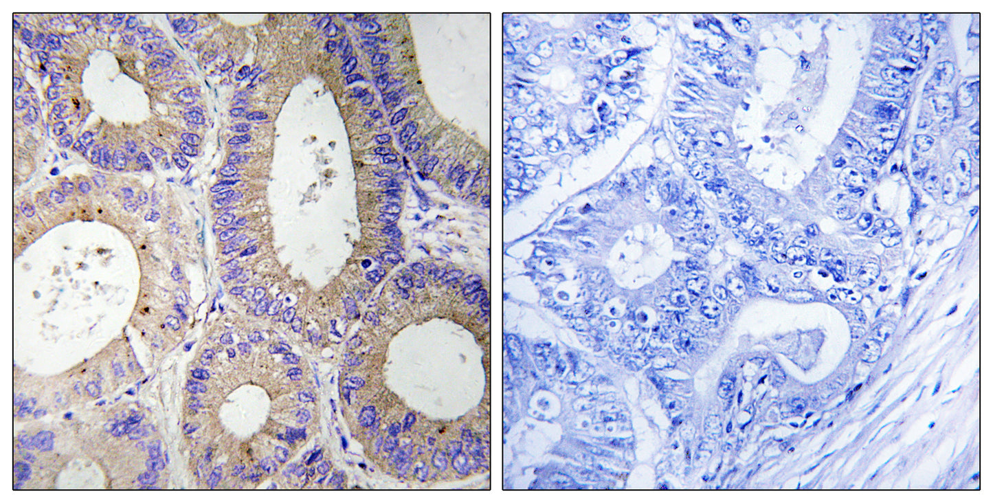 Carbonyl Reductase 3 Rabbit Polyclonal Antibody