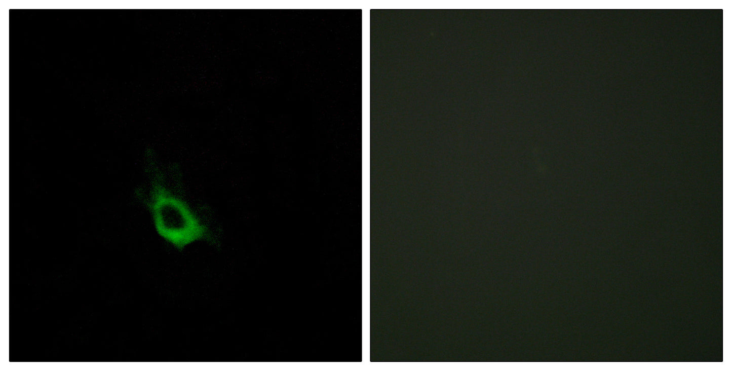 CARD 10 Rabbit Polyclonal Antibody