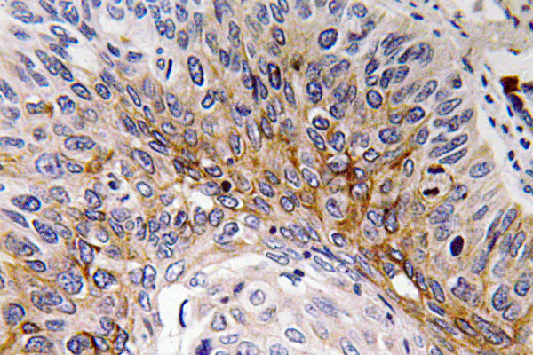Cardiotrophin-1 Rabbit Polyclonal Antibody